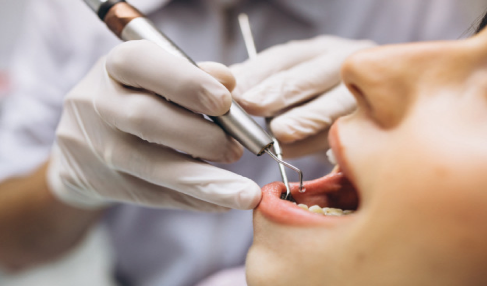 Hukum Pasang Gigi Palsu Agar Lebih Kuat